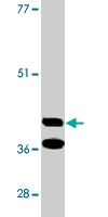 PAB9777 - BNIP3L / BNIP3A