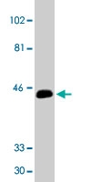 PAB9779 - CD186 / CXCR6