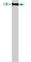 PAB9782 - BUB1B