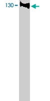 PAB9783 - BUB1B