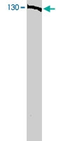 PAB9784 - BUB1B