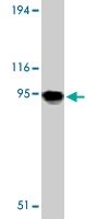PAB9787 - TLR11
