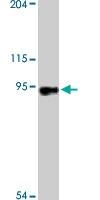PAB9789 - RNF216