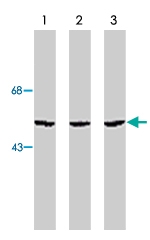 PAB9841 - CHK1
