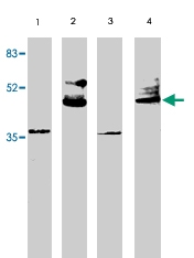 PAB9842 - VSX2 / CHX10