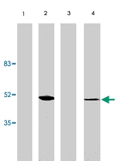PAB9843 - VSX2 / CHX10