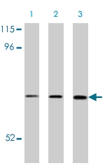 PAB9844 - CRMP1 / DPYSL1