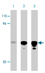 PAB9845 - CRMP1 / DPYSL1