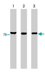 PAB9846 - MARK3