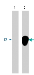 PAB9853 - TYROBP / DAP12