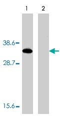 PAB9858 - Deoxyribonuclease-2-alpha