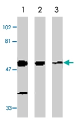 PAB9860 - STK17A / DRAK1