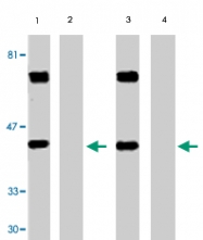 PAB9861 - STK17B / DRAK2