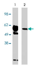PAB9873 - FBXW7