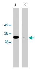 PAB9874 - FHL2 / SLIM3
