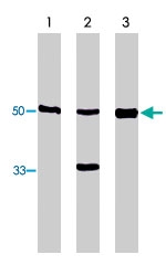 PAB9876 - FLI1