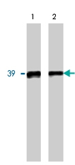 PAB9887 - Transducin beta chain 5 (GNB5)