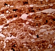 PAB9896 - Glypican-3 / GPC3