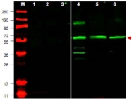 PAB9923 - PTENP1