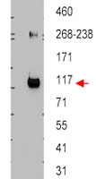 PAB9925 - ABCB5