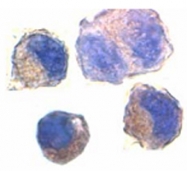 PAB9928 - CD156c / ADAM10