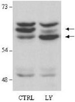 PAB9933 - AKT2 / PKB beta
