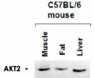 PAB9933 - AKT2 / PKB beta