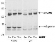 PAB9933 - AKT2 / PKB beta