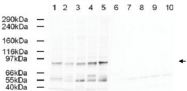 PAB9935 - AP2A1 / ADTAA
