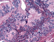 PAB9936 - APC1 / ANAPC1
