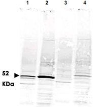 PAB9938 - CAMK4
