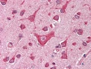 PAB9938 - CAMK4