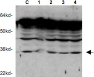 PAB9939 - CDK1