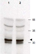 PAB9940 - CDK2