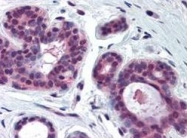 PAB9940 - CDK2