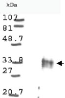 PAB9944 - Cyclin D1