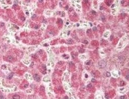 PAB9950 - Cyclooxygenase 2