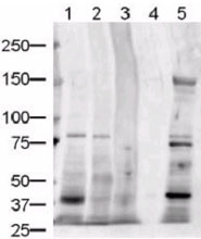 PAB9954 - CD339 / JAG1