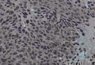 PAB9954 - CD339 / JAG1