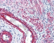 PAB9961 - MYL6