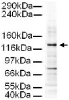 PAB9965 - AP3 complex subunit delta-1 / AP3D1