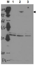 PAB9975 - TP53BP2
