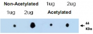 PAB9976 - TRIM29 / ATDC