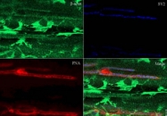 PAB9980 - Actin beta / ACTB