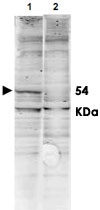 PAB9984 - CAMK2G / CAMKG