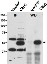 PAB9985 - CBLC / RNF57