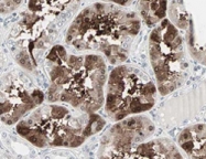 PAB9985 - CBLC / RNF57