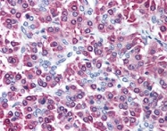 PAB9985 - CBLC / RNF57