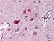 PAB9990 - CDK5