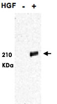 PAB9992 - HGF receptor